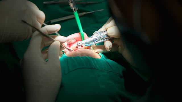 Cắm trụ implant có đau không? Mất bao lâu?