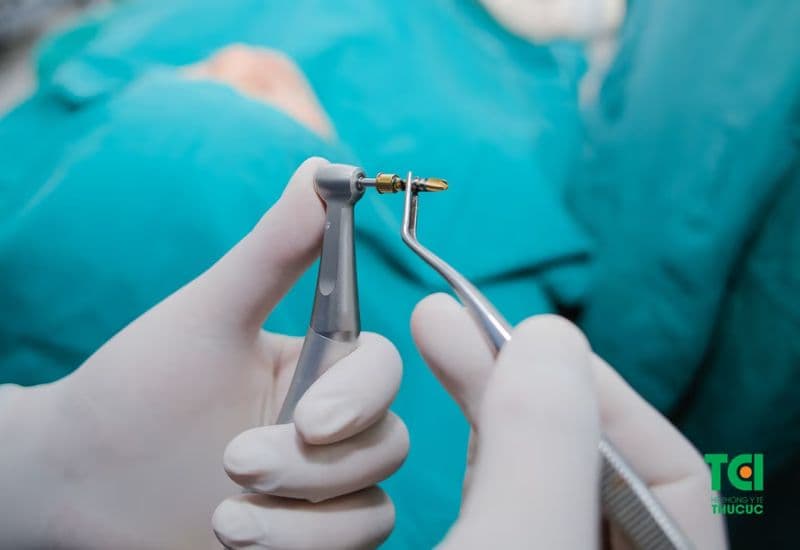cắm trụ răng có nguy hiểm không