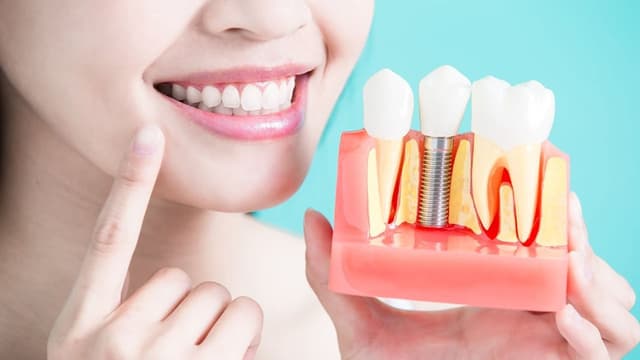 Cắm trụ răng có nguy hiểm không?