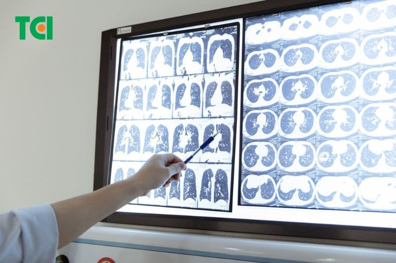 chụp ct toàn thân tầm soát ung thư
