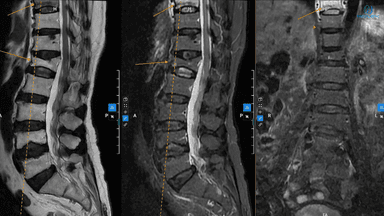 Chỉ định và quy trình chụp mri cột sống cổ tại Thu Cúc TCI