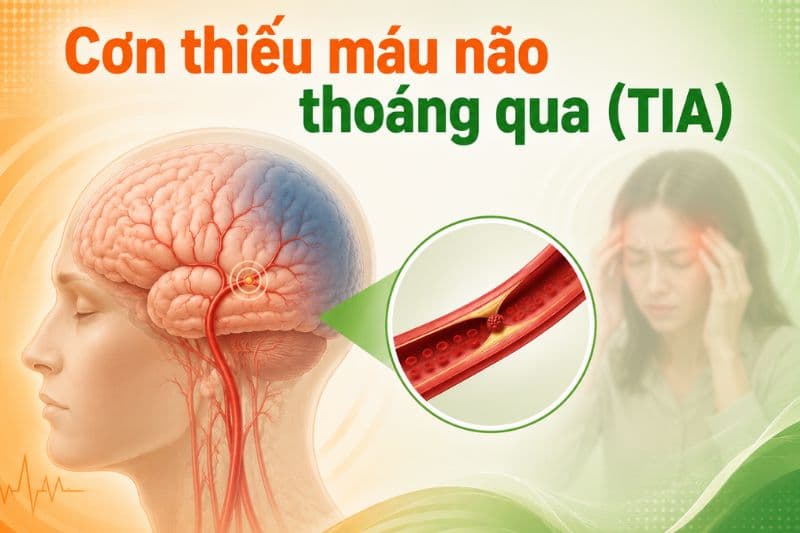cơn thiếu máu não thoáng qua