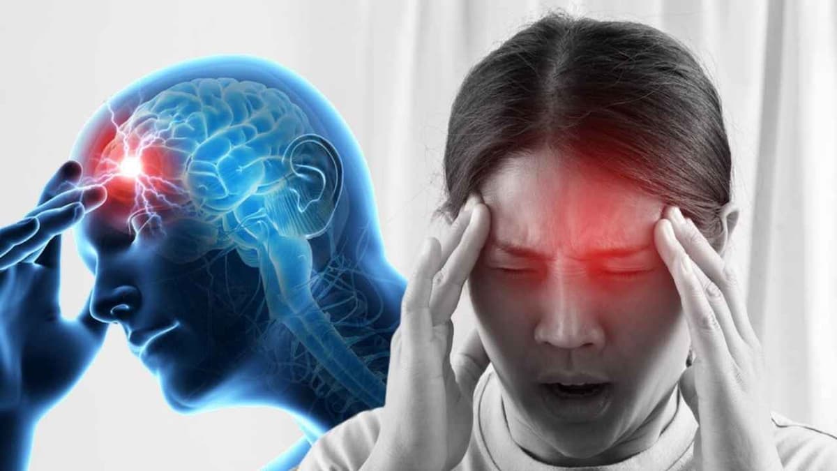 Đau đầu migraine nguyên nhân là gì?