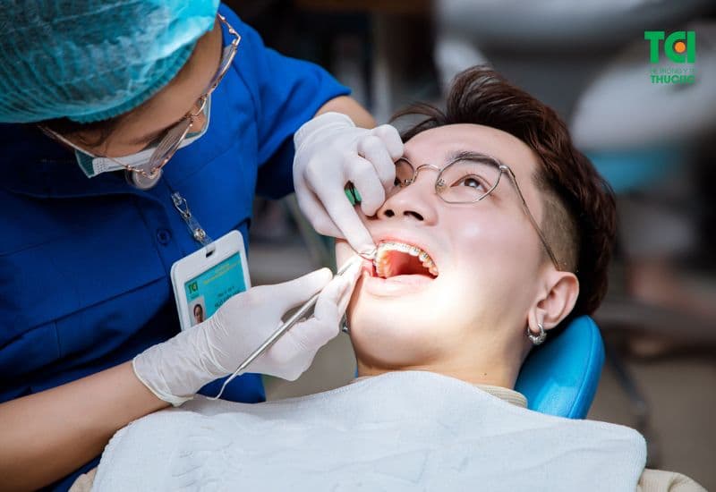 dấu hiệu tiêu xương răng khi niềng