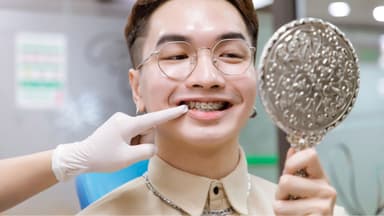 Dấu hiệu tiêu xương răng khi niềng