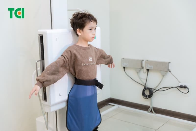 dấu hiệu u tuyến giáp ở trẻ