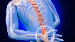 Đau lưng cấp là gì? Dấu hiệu và cách điều trị