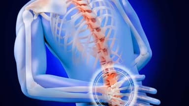 Đau lưng cấp là gì? Dấu hiệu và cách điều trị