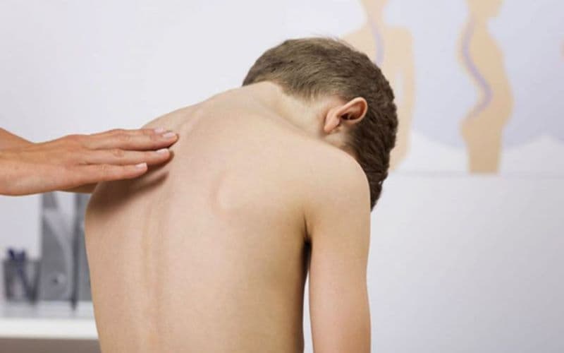 lý do bị thoát vị đĩa đệm