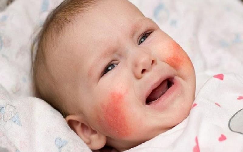 dị ứng đạm bò uống sữa dê được không