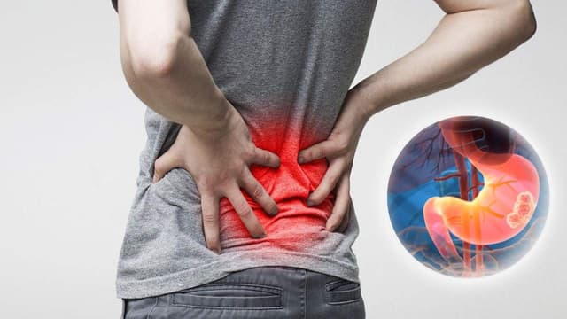 Ung thư dạ dày có đau lưng không?