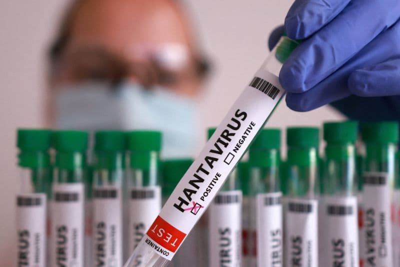 Hantavirus là bệnh gì?