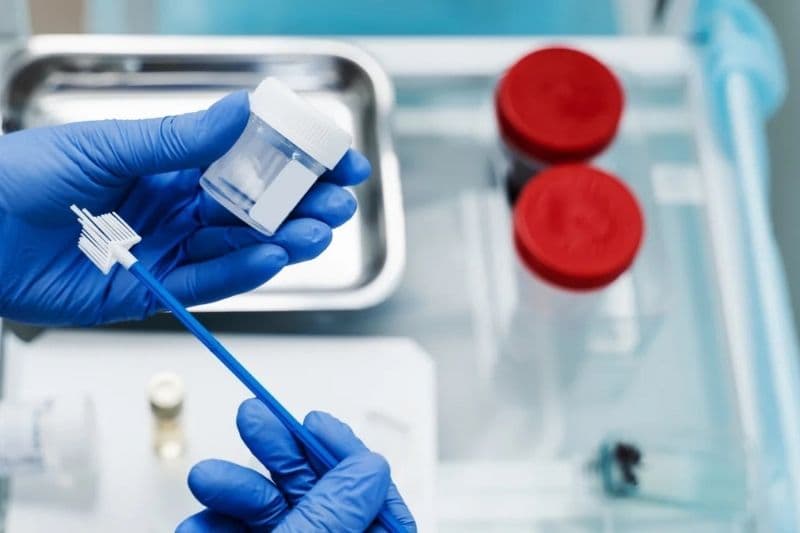 khám tiền hôn nhân có xét nghiệm hpv không