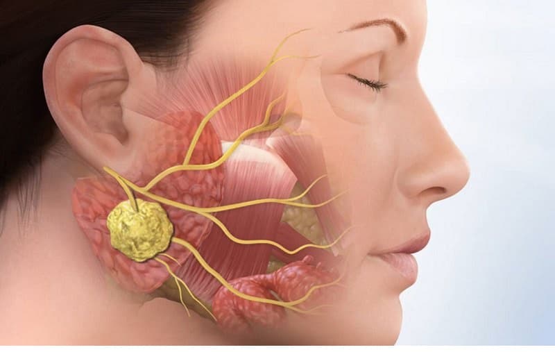 chỉ định chụp mri cột sống cổ