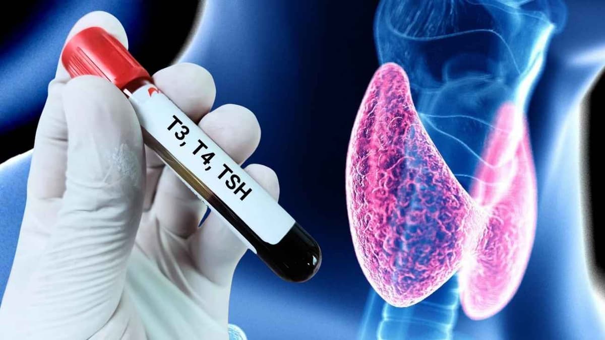 Kiểm tra hormone tuyến giáp thế nào?