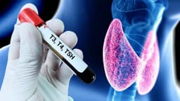 Kiểm tra hormone tuyến giáp thế nào?