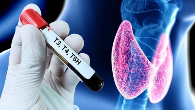 Kiểm tra hormone tuyến giáp thế nào?