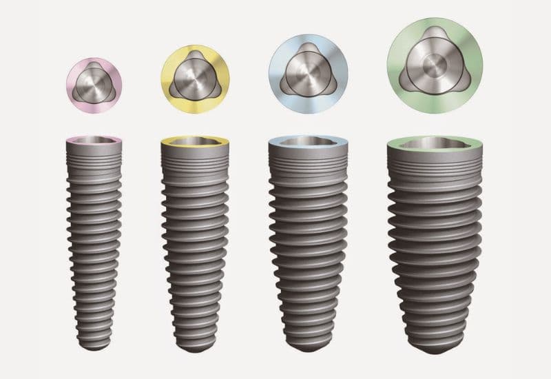 lưu ý trước khi trồng răng implant