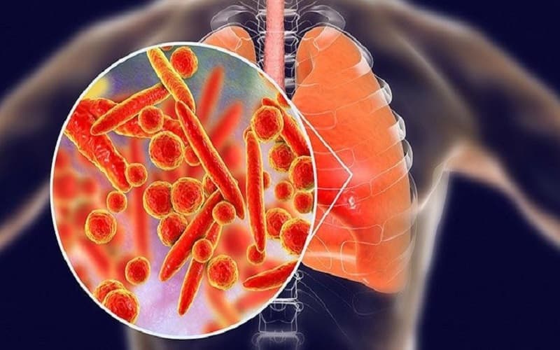 vi khuẩn mycoplasma gây bệnh gì