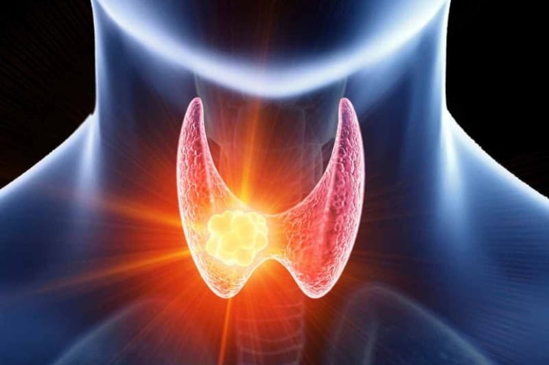 nang tuyến giáp 4mm