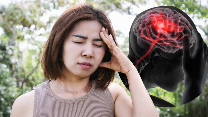 Nhồi máu não có phải là đột quỵ không?