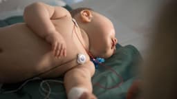 Phác đồ điều trị suy tim ở trẻ em