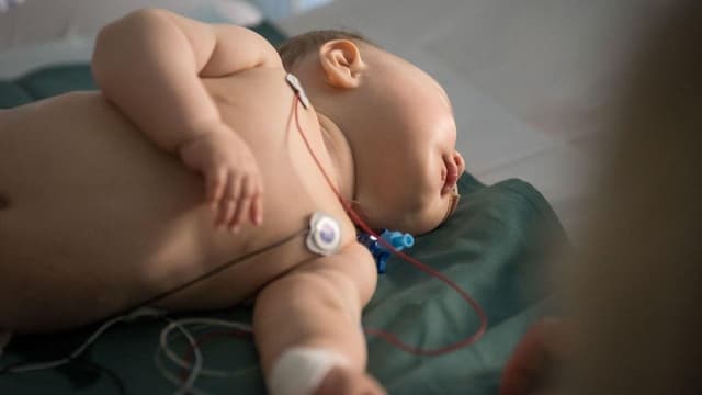 Phác đồ điều trị suy tim ở trẻ em