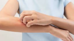 Phác đồ điều trị viêm da tiếp xúc dị ứng