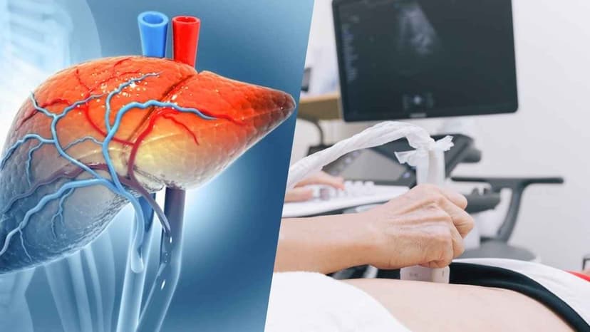 Bỏ túi quy trình tầm soát ung thư gan