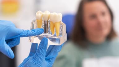 Quy trình trồng răng implant chuẩn y khoa