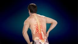 Thoát vị đĩa đệm có làm nặng được không?