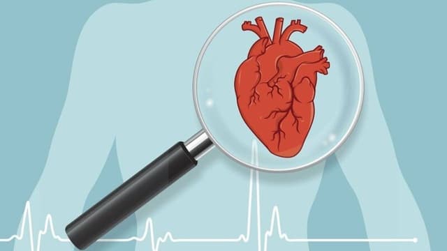 Tiêu chuẩn chẩn đoán nhồi máu cơ tim
