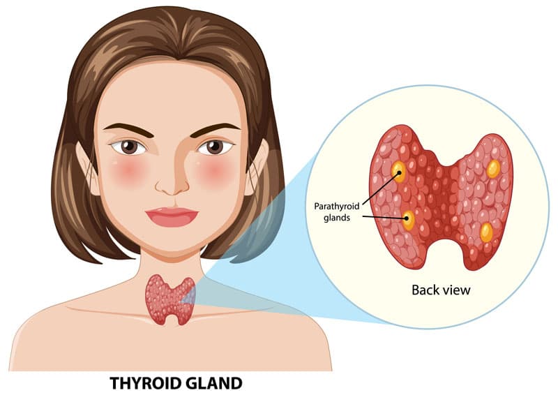 trẻ em bị nhân tuyến giáp có nguy hiểm không