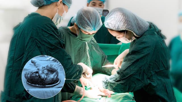 Khối u xơ tử cung nặng gần 3kg và hành trình xử trí an toàn tại TCI