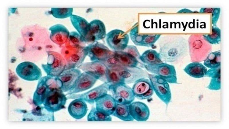 vi khuẩn chlamydia gây bệnh gì