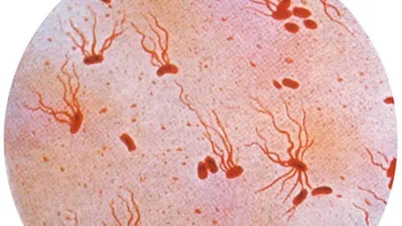 salmonella typhimurium là vi khuẩn gây bệnh gì