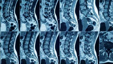 Các vị trí thoát vị đĩa đệm thường gặp