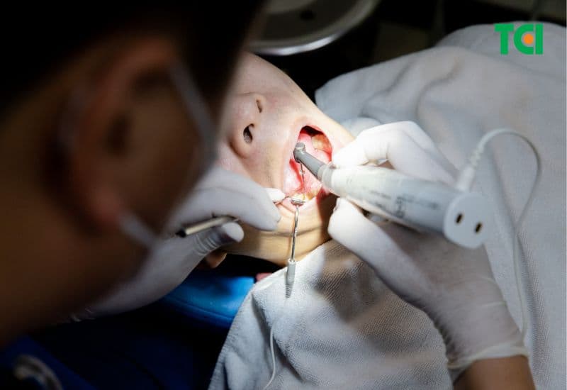 viêm tủy răng không hồi phục