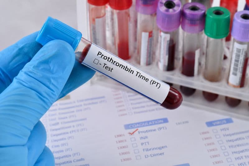 thời gian prothrombin là gì