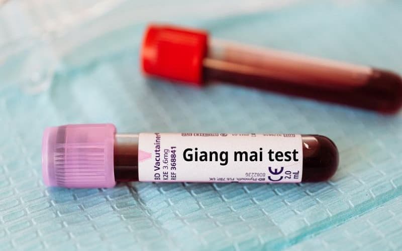 dấu hiệu bệnh giang mai giai đoạn 1