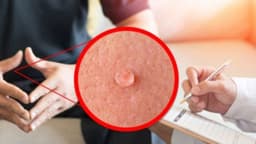 Cập nhật danh sách bác sĩ giỏi chữa sùi mào gà ở Thanh Trì được đánh giá cao
