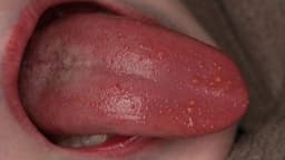TOP danh sách bác sĩ giỏi chữa sùi mào gà ở Linh Đàm
