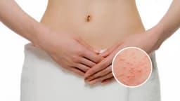 Cách trị viêm nang lông vùng kín