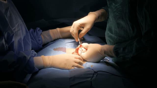 Tại sao nam giới nên cắt bao quy đầu?