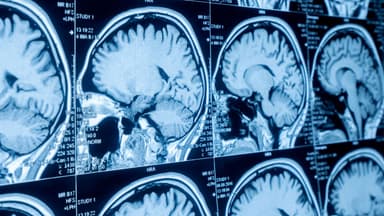 Chụp MRI não có nguy hiểm không?