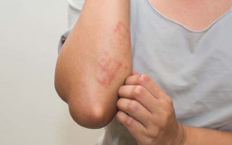 dấu hiệu suy thận giai đoạn đầu ở nữ