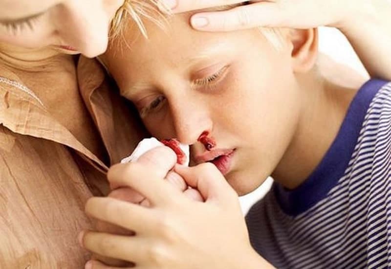dấu hiệu bệnh bạch cầu ở trẻ em