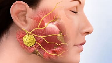 Dấu hiệu bệnh quai bị ở phụ nữ