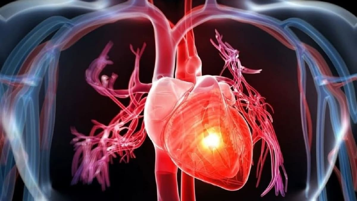 Dấu hiệu của bệnh hở van tim 2 lá