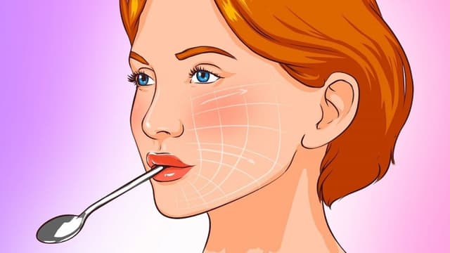 Dấu hiệu của bệnh liệt dây thần kinh số 7
